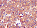 CLOCK Antibody in Immunohistochemistry (Paraffin) (IHC (P))