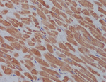 ULK1 Antibody in Immunohistochemistry (Paraffin) (IHC (P))