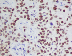 Phospho-JAK2 (Tyr1007, Tyr1008) Antibody in Immunohistochemistry (Paraffin) (IHC (P))