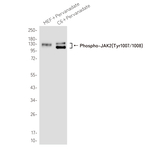 Phospho-JAK2 (Tyr1007, Tyr1008) Antibody in Western Blot (WB)