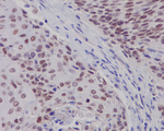 Estrogen Receptor beta Antibody in Immunohistochemistry (Paraffin) (IHC (P))