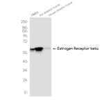 Estrogen Receptor beta Antibody in Western Blot (WB)