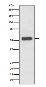 Estrogen Receptor beta Antibody in Western Blot (WB)