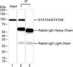 STAT5 alpha/beta Antibody in Immunoprecipitation (IP)