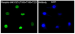 Phospho-JNK1/JNK2/JNK3 (Thr183) Recombinant Rabbit Monoclonal Antibody (K01_4U31)