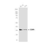 C/EBP beta Antibody in Western Blot (WB)