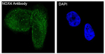 NOX4 Recombinant Rabbit Monoclonal Antibody (K01_4U39)