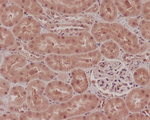 NOX4 Antibody in Immunohistochemistry (Paraffin) (IHC (P))