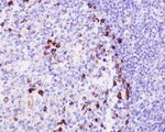 CD9 Antibody in Immunohistochemistry (Paraffin) (IHC (P))