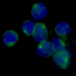 LOX Recombinant Rabbit Monoclonal Antibody (K01_4U51)