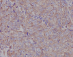LOX Antibody in Immunohistochemistry (Paraffin) (IHC (P))