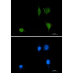 Phospho-delta Catenin (Tyr228) Recombinant Rabbit Monoclonal Antibody (K01_1L74)
