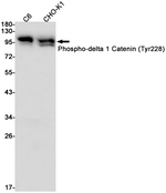 Phospho-delta Catenin (Tyr228) Antibody in Western Blot (WB)