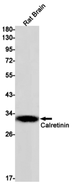 Calretinin Antibody in Western Blot (WB)