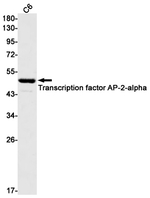 AP2 alpha Recombinant Rabbit Monoclonal Antibody (K01_1M83)