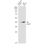 AGXT Recombinant Rabbit Monoclonal Antibody (K01_1M48)