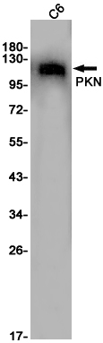 PKN1 Recombinant Rabbit Monoclonal Antibody (K01_1W88)