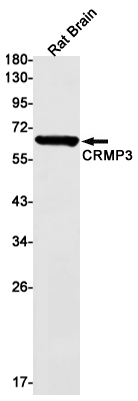 CRMP3 Recombinant Rabbit Monoclonal Antibody (K01_1P84)
