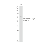 Phospho-c-Myc (Ser62) Antibody in Western Blot (WB)