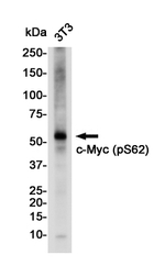 Phospho-c-Myc (Ser62) Antibody in Western Blot (WB)