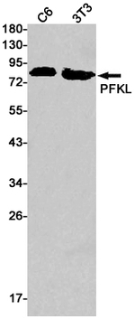PFKL Recombinant Rabbit Monoclonal Antibody (K01_1W64)