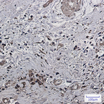 Phospho-PAK1/2/3 (Ser144, Ser141, Ser154) Antibody in Immunohistochemistry (Paraffin) (IHC (P))