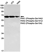 Phospho-PAK1/2/3 (Ser144, Ser141, Ser154) Antibody in Western Blot (WB)