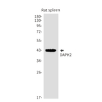 DAPK2 Antibody in Western Blot (WB)