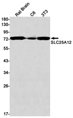 SLC25A12 Recombinant Rabbit Monoclonal Antibody (K01_1Y47)