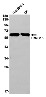 LRRC15 Antibody in Western Blot (WB)