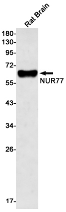 Nur77 Recombinant Rabbit Monoclonal Antibody (K01_1W04)