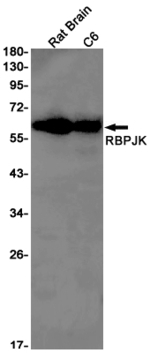RBPJ Recombinant Rabbit Monoclonal Antibody (K01_1X70)