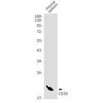 CD39 Recombinant Rabbit Monoclonal Antibody (K01_1P22)