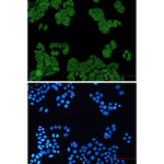 PP2A alpha/beta Recombinant Rabbit Monoclonal Antibody (K01_1W97)