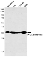 PP2A alpha/beta Antibody in Western Blot (WB)