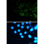Phospho-FLNA/FLNB (Ser2152, Ser2107) Recombinant Rabbit Monoclonal Antibody (K01_2K92)