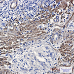 Phospho-FLNA/FLNB (Ser2152, Ser2107) Antibody in Immunohistochemistry (Paraffin) (IHC (P))