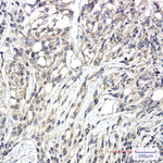 Phospho-PKC zeta/gamma (Thr410, Thr412) Recombinant Rabbit Monoclonal Antibody (K01_2L07)
