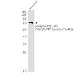 Phospho-PKC zeta/gamma (Thr410, Thr412) Antibody in Western Blot (WB)