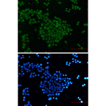 SKP2 Antibody in Immunocytochemistry (ICC/IF)