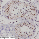 PBRM1 Antibody in Immunohistochemistry (Paraffin) (IHC (P))