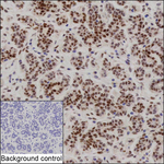 BRCA1 Antibody in Immunohistochemistry (Paraffin) (IHC (P))