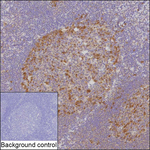 CDK2 Antibody in Immunohistochemistry (Paraffin) (IHC (P))
