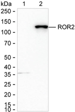 ROR2 Antibody in Western Blot (WB)