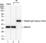CD20 Antibody in Immunoprecipitation (IP)