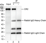 CD21 Antibody in Immunoprecipitation (IP)