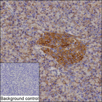 ENT1 Recombinant Rabbit Monoclonal Antibody (K01_3M64)