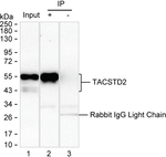 TROP2 Antibody in Immunoprecipitation (IP)