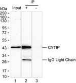 CYTIP Recombinant Mouse Monoclonal Antibody (K8U038_15B9)