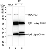 HDGFRP2 Antibody in Immunoprecipitation (IP)